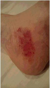 biomedres-openaccess-journal-bjstr