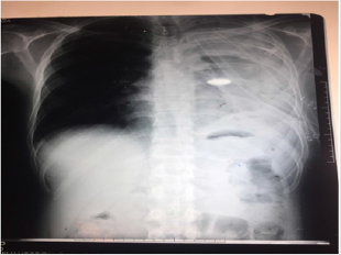 biomedres-openaccess-journal-bjstr