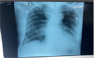 biomedres-openaccess-journal-bjstr