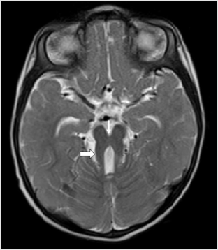biomedres-openaccess-journal-bjstr