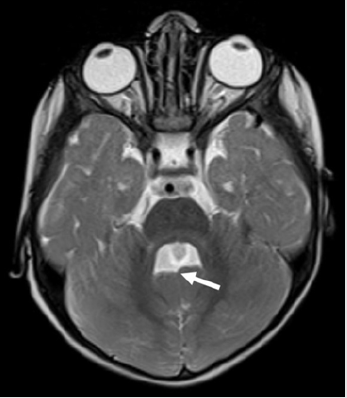 biomedres-openaccess-journal-bjstr