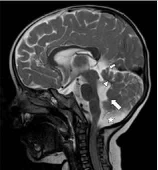 biomedres-openaccess-journal-bjstr