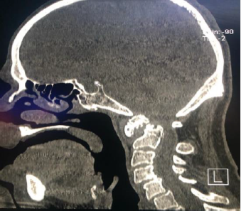 biomedres-openaccess-journal-bjstr