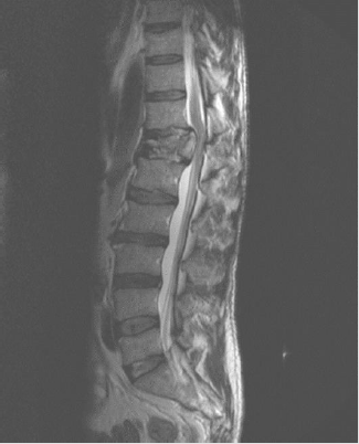 biomedres-openaccess-journal-bjstr