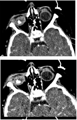 biomedres-openaccess-journal-bjstr