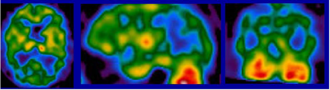 biomedres-openaccess-journal-bjstr