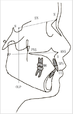 biomedres-openaccess-journal-bjstr