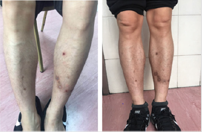 biomedres-openaccess-journal-bjstr