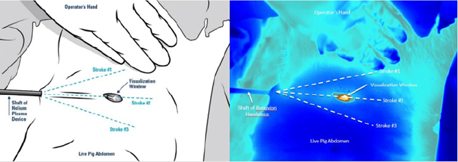 biomedres-openaccess-journal-bjstr