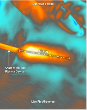 biomedres-openaccess-journal-bjstr