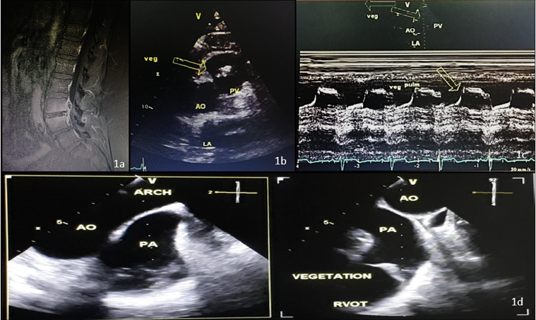 biomedres-openaccess-journal-bjstr