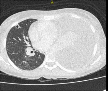 biomedres-openaccess-journal-bjstr