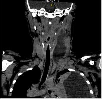 biomedres-openaccess-journal-bjstr