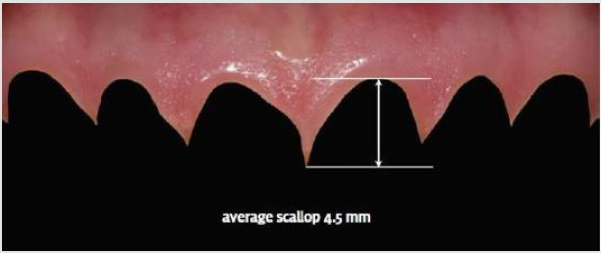 biomedres-openaccess-journal-bjstr