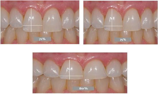 biomedres-openaccess-journal-bjstr
