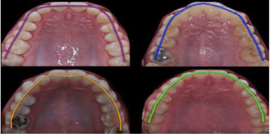 biomedres-openaccess-journal-bjstr