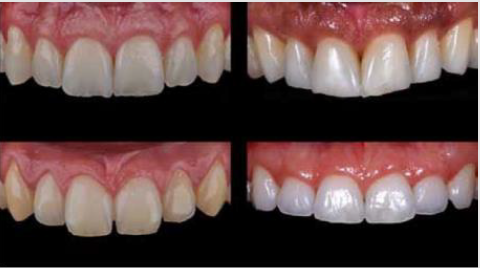 biomedres-openaccess-journal-bjstr