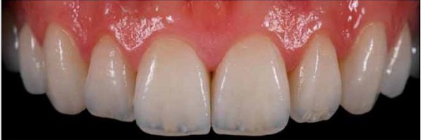 biomedres-openaccess-journal-bjstr