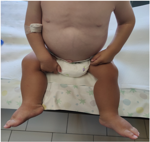 biomedres-openaccess-journal-bjstr