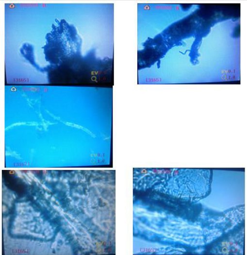 biomedres-openaccess-journal-bjstr