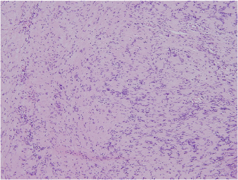 biomedres-openaccess-journal-bjstr