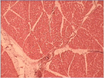 biomedres-openaccess-journal-bjstr
