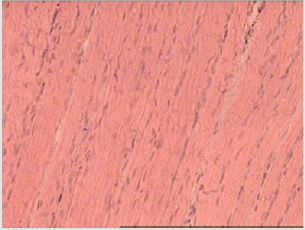 biomedres-openaccess-journal-bjstr