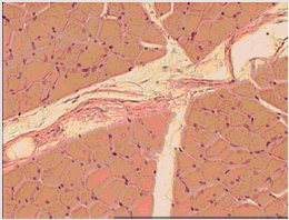 biomedres-openaccess-journal-bjstr