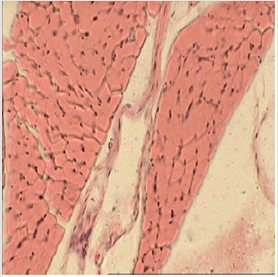 biomedres-openaccess-journal-bjstr