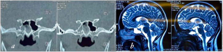 biomedres-openaccess-journal-bjstr