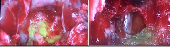 biomedres-openaccess-journal-bjstr