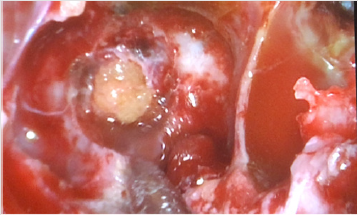 biomedres-openaccess-journal-bjstr