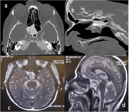biomedres-openaccess-journal-bjstr