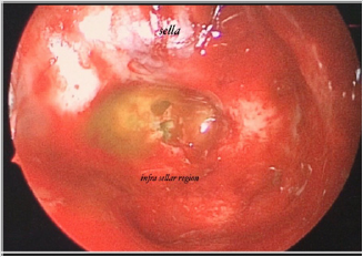 biomedres-openaccess-journal-bjstr