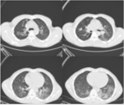 biomedres-openaccess-journal-bjstr