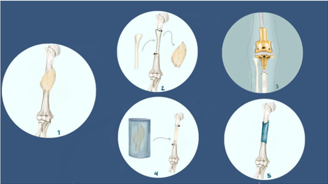 biomedres-openaccess-journal-bjstr