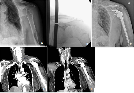 biomedres-openaccess-journal-bjstr