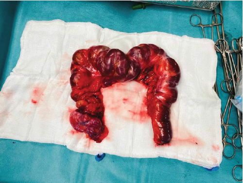 biomedres-openaccess-journal-bjstr