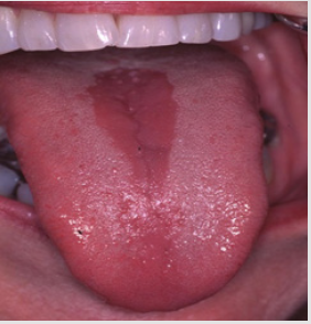 biomedres-openaccess-journal-bjstr