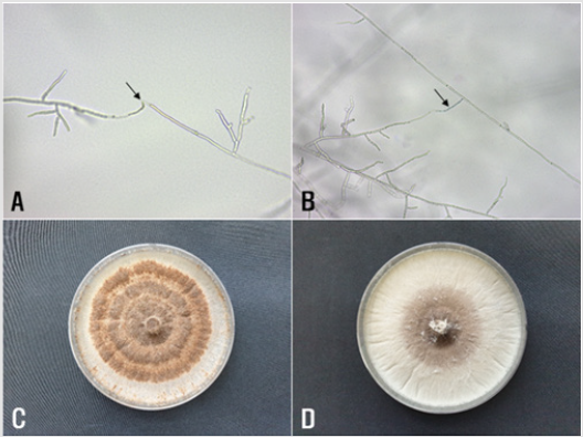 biomedres-openaccess-journal-bjstr