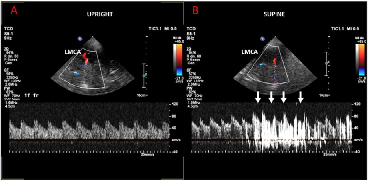 biomedres-openaccess-journal-bjstr