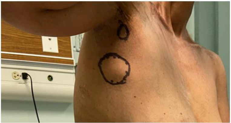 biomedres-openaccess-journal-bjstr