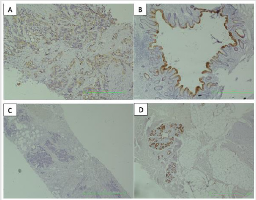 biomedres-openaccess-journal-bjstr