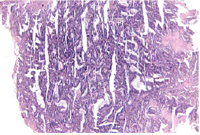 biomedres-openaccess-journal-bjstr