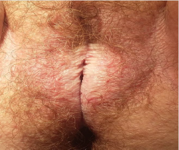 biomedres-openaccess-journal-bjstr