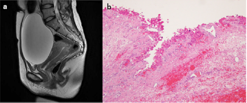 biomedres-openaccess-journal-bjstr