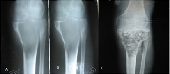 biomedres-openaccess-journal-bjstr