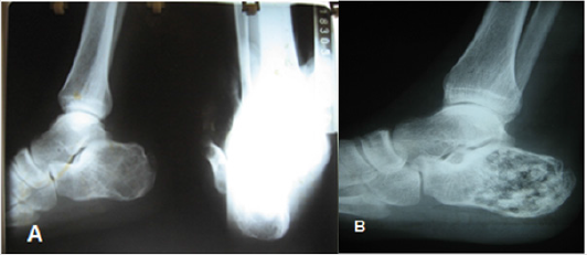biomedres-openaccess-journal-bjstr