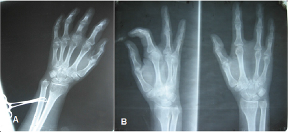 biomedres-openaccess-journal-bjstr