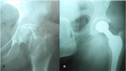 biomedres-openaccess-journal-bjstr